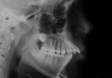 Cephalomentric Images